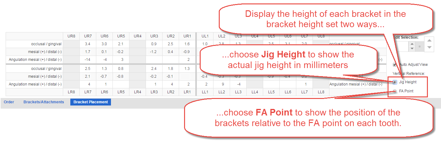 Using the Bracket Placement Tab